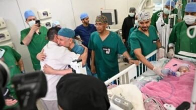 والد التوام الملتصق بعد نجاح العملية